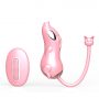 Remote Control Vibrating Eggs G-Spot Stimulation Vibrator (1)